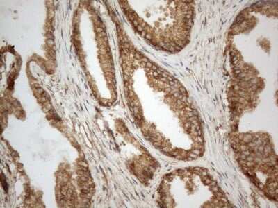 Immunohistochemistry: VAP-A Antibody (10E10) [NBP2-46319] - Analysis of Human prostate tissue. (Heat-induced epitope retrieval by 1mM EDTA in 10mM Tris buffer (pH8.5) at 120C for 3 min)