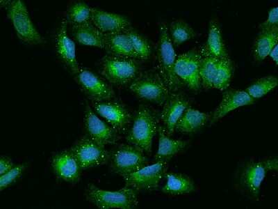 Immunocytochemistry/Immunofluorescence: VAP-A Antibody [NBP2-97848] - Immunofluorescence staining of VAP-A in U2OS cells. Cells were fixed with 4% PFA, permeabilzed with 0.1% Triton X-100 in PBS, blocked with 10% serum, and incubated with rabbit anti-Human VAP-A polyclonal antibody (dilution ratio 1:200) at 4C overnight. Then cells were stained with the Alexa Fluor(R)488-conjugated Goat Anti-rabbit IgG secondary antibody (green) and counterstained with DAPI (blue).Positive staining was localized to Cytoplasm.