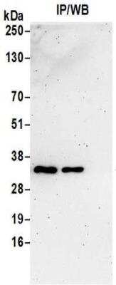 Immunoprecipitation: VAP-A Antibody [NBP2-32249] - Samples:  Whole cell lysate (0.5 or 1.0 mg per IP reaction; 20% of IP loaded) prepared using NETN buffer from 293T cells.  Antibodies:  Affinity purified rabbit anti-VAPA antibody NBP2-32249 used for IP at 6 ug per reaction. VAPA was also immunoprecipitated by rabbit anti-VAPA antibody BL16444.  For blotting immunoprecipitated VAPA, NBP2-32249 was used at 1 ug/ml.  Detection: Chemiluminescence with an exposure time of 3 minutes.