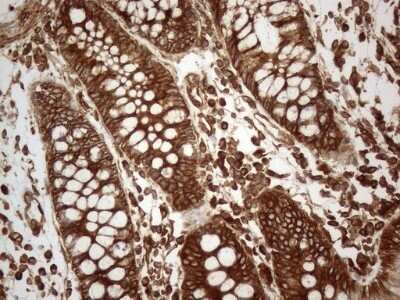 Immunohistochemistry: VAP-A Antibody (OTI10E10) - Azide and BSA Free [NBP2-74825] - Analysis of Human colon tissue. (Heat-induced epitope retrieval by 1mM EDTA in 10mM Tris buffer (pH8.5) at 120C for 3 min)