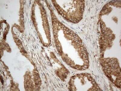 Immunohistochemistry: VAP-A Antibody (OTI10E10) - Azide and BSA Free [NBP2-74825] - Analysis of Human prostate tissue. (Heat-induced epitope retrieval by 1mM EDTA in 10mM Tris buffer (pH8.5) at 120C for 3 min)