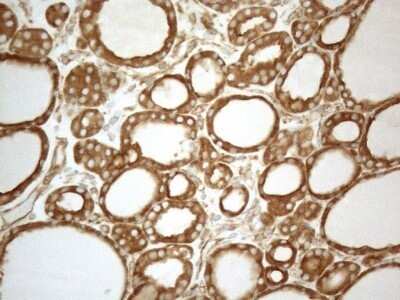 Immunohistochemistry: VAP-A Antibody (OTI10E10) - Azide and BSA Free [NBP2-74825] - Analysis of Human thyroid tissue. (Heat-induced epitope retrieval by 1mM EDTA in 10mM Tris buffer (pH8.5) at 120C for 3 min)