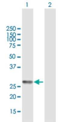 Western Blot: VAP-A Antibody [H00009218-B01P] - Analysis of VAPA expression in transfected 293T cell line by VAPA polyclonal antibody.  Lane 1: VAPA transfected lysate(26.62 KDa). Lane 2: Non-transfected lysate.