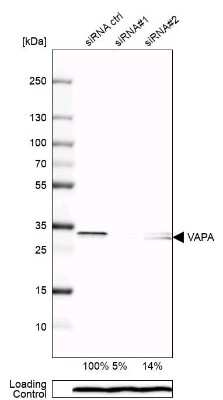 Western Blot: VAP-A Antibody [NBP1-83132] - Analysis in U-138MG cells transfected with control siRNA, target specific siRNA probe #1 and #2,. Remaining relative intensity is presented. Loading control: Anti-PPIB.