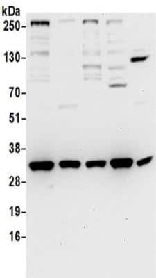 Western Blot: VAP-A Antibody [NBP2-32249] - Samples:  Whole cell lysate (50 ug) prepared using NETN or RIPA buffer from HeLa, 293T, Jurkat, and mouse TCMK-1 cells. Antibodies:  Affinity purified rabbit anti-VAPA antibody NBP2-32249 used for WB at 0.4 ug/ml. Detection: Chemiluminescence with an exposure time of 30 seconds.