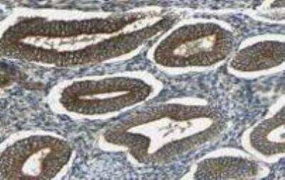 Immunohistochemistry: VAP-B Antibody [21200002] - Staining for vesicle-associated membrane protein B/C (VAPB) in human uterine corpus.  Glandular cells stained strongly while cells in the endometrial stroma did not stain or stained weakly.  This image is the courtesy of the Human Proteome Resource (HPR).