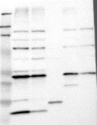 Western Blot: VAP-B Antibody [21200002] - Samples:  Lane 1, Marker [kDa]: 219, 111, 83, 48, 32, 26, 17  Lane 2, RT-4 Lane 3, U-251MG sp  Lane 4, Human Plasma  Lane 5, Liver  Lane 6, Tonsil , Target weight [kDa]:   27, 17, 11 (splice variants)   Validation score:   2   Validation description:   Supportive - Band of predicted size in kDa (+/-20%) with additional bands present.
