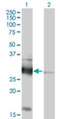Western Blot: VAP-B Antibody [H00009217-B01P] - Analysis of VAPB expression in transfected 293T cell line by VAPB polyclonal antibody.  Lane 1: VAPB transfected lysate(26.73 KDa). Lane 2: Non-transfected lysate.