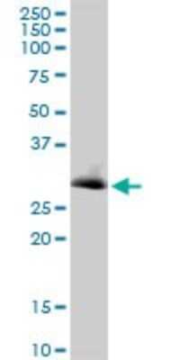 Western Blot: VAP-B Antibody [H00009217-B02P] - Analysis of VAPB expression in HeLa.