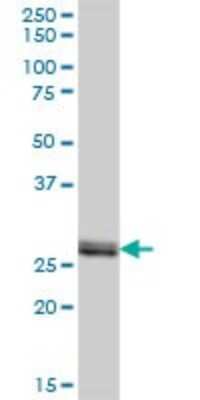 Western Blot: VAP-B Antibody [H00009217-B02P] - Analysis of VAPB expression in human placenta.