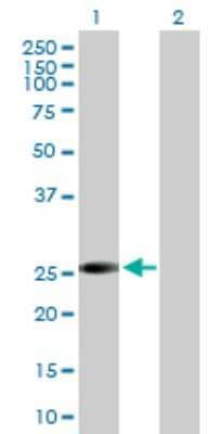 Western Blot: VAP-B Antibody [H00009217-B02P] - Analysis of VAPB expression in transfected 293T cell line by VAPB polyclonal antibody.  Lane 1: VAPB transfected lysate(26.73 KDa). Lane 2: Non-transfected lysate.