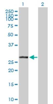 Western Blot: VAP-B Antibody [H00009217-D01P] - Analysis of VAPB expression in transfected 293T cell line by VAPB polyclonal antibody.Lane 1: VAPB transfected lysate(27.20 KDa).Lane 2: Non-transfected lysate.
