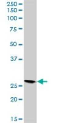 Western Blot: VAP-B Antibody [H00009217-D03P] - Analysis of VAPB expression in mouse kidney.