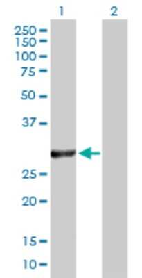 Western Blot: VAP-B Antibody [H00009217-D03P] - Analysis of VAPB expression in transfected 293T cell line by VAPB polyclonal antibody.Lane 1: VAPB transfected lysate(26.73 KDa).Lane 2: Non-transfected lysate.