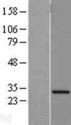 Western Blot VAP-A Overexpression Lysate