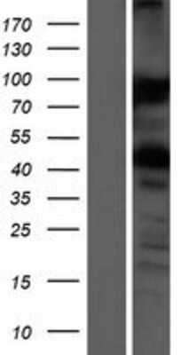 Western Blot: VAPA Overexpression Lysate (Adult Normal) [NBP2-07981] Left-Empty vector transfected control cell lysate (HEK293 cell lysate); Right -Over-expression Lysate for VAPA.