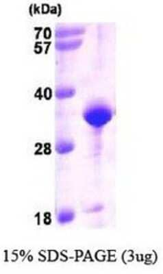 SDS-Page: Recombinant Human VAP-A Protein [NBP1-37090] - VAPA, 29.8 kDa (264aa), confirmed by MALDI-TOF with a purity of 85% by SDS - PAGE