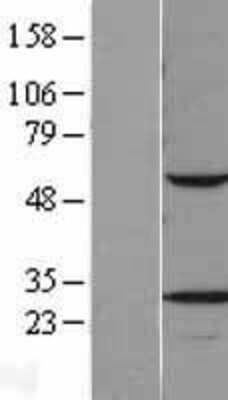 Western Blot: VAPB Overexpression Lysate (Adult Normal) [NBL1-17694] Left-Empty vector transfected control cell lysate (HEK293 cell lysate); Right -Over-expression Lysate for VAPB.