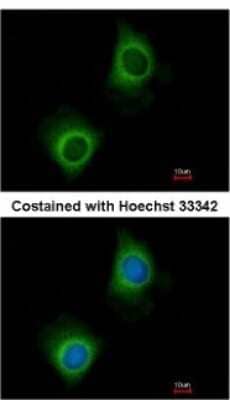 Immunocytochemistry/Immunofluorescence: VARS Antibody [NBP2-20843] - Analysis of methanol-fixed HeLa, using antibody at 1:200 dilution.