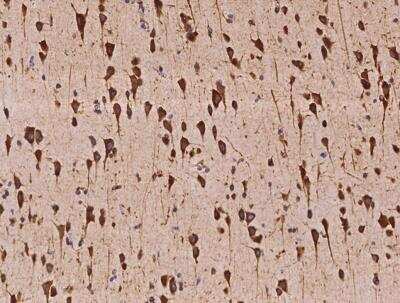 Immunohistochemistry-Paraffin: VARS Antibody [NBP3-05970] - Staining of human VARS in human brain with rabbit polyclonal antibody at 1:500 dilution.