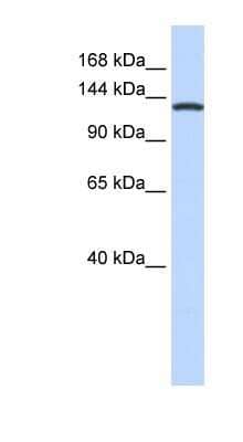 Western Blot: VARS Antibody [NBP1-55365] - 721_B cell lysate, concentration 0.2-1 ug/ml.