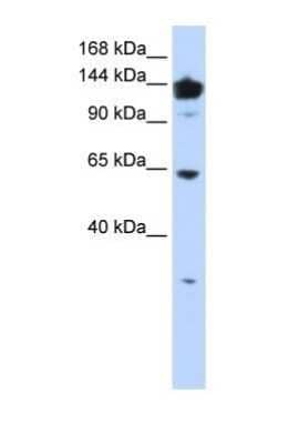 Western Blot: VARS Antibody [NBP1-55366] - 721_B tissue lysate at a concentration of 1ug/ml.