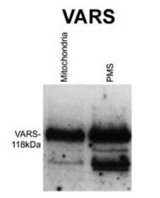 Western Blot: VARS Antibody [NBP1-55366] - Titration: 1 ug/ml Positive Control: Wildtype Neurospora crassa