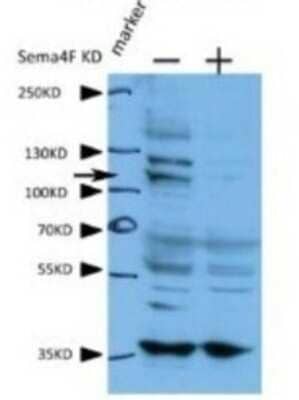 Western Blot: VARS Antibody [NBP1-55366] - Titration: 1.6 ug/ml Positive Control: human cell lines A431
