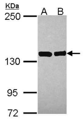 Western Blot VARS Antibody