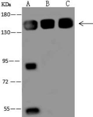 Western Blot: VARS Antibody [NBP3-05970] - Lane A: HepG2 Whole Cell LysateLane B: HeLa Whole Cell LysateLane C: K562 Whole Cell LysateLysates/proteins at 30 ug per lane.SecondaryGoat Anti-Rabbit IgG (H+L)/HRP at 1/10000 dilution.Developed using the ECL technique.Performed under reducing conditions.Predicted band size:140 kDaObserved band size:140 kDa(We are unsure as to the identity of these extra bands.)