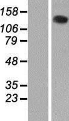 Western Blot VARS Overexpression Lysate