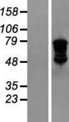 Western Blot: VASA Overexpression Lysate (Adult Normal) [NBL1-09796] Left-Empty vector transfected control cell lysate (HEK293 cell lysate); Right -Over-expression Lysate for VASA.