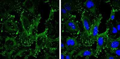 Immunocytochemistry/Immunofluorescence: VASP Antibody (GT238) [NBP3-13619] - VASP antibody [GT238] detects VASP protein at focal adhesion by immunofluorescent analysis. Sample: HeLa cells were fixed in 4% paraformaldehyde at RT for 15 min. Green: VASP stained by VASP antibody [GT238] (NBP3-13619) diluted at 1:500. Blue: Hoechst 33342 staining.