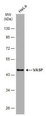 Western Blot: VASP Antibody (GT238) [NBP3-13619] - Whole cell extract (30 ug) was separated by 10% SDS-PAGE, and the membrane was blotted with VASP antibody [GT238] (NBP3-13619) diluted at 1:5000. The HRP-conjugated anti-mouse IgG antibody (NBP2-19382) was used to detect the primary antibody.