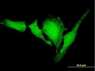 Immunocytochemistry/Immunofluorescence: VASP Antibody [H00007408-B01P] - Analysis of purified antibody to VASP on HeLa cell. (antibody concentration 10 ug/ml)