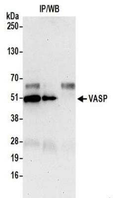 Immunoprecipitation: VASP Antibody [NBP2-41363] - Samples: Whole cell lysate (0.5 or 1.0 mg per IP reaction; 20% of IP loaded) from 293T cells prepared using NETN lysis buffer. Antibody: Affinity purified rabbit anti-VASP antibody NBP2-41363 used for IP at 6 ug per reaction. For blotting immunoprecipitated VASP, it was used at 0.4 ug/ml. Detection: Chemiluminescence with an exposure time of 30 seconds.