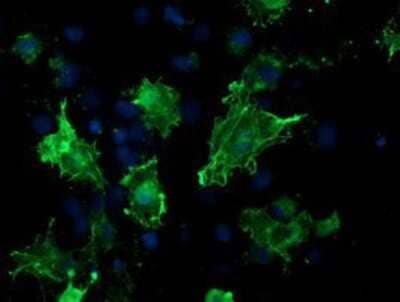 Immunocytochemistry/Immunofluorescence: VASP Antibody (OTI4D6) - Azide and BSA Free [NBP2-74830] - Staining of COS7 cells transiently transfected by pCMV6-ENTRY VASP.