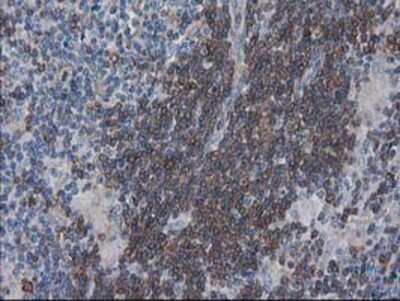 Immunohistochemistry: VASP Antibody (OTI4D6) - Azide and BSA Free [NBP2-74830] - Staining of paraffin-embedded Human lymphoma tissue using anti-VASP mouse monoclonal antibody.