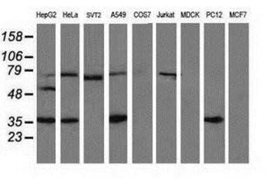 Western Blot: VASP Antibody (OTI4D6) - Azide and BSA Free [NBP2-74830] - Analysis of extracts (35ug) from 9 different cell lines by using anti-VASP monoclonal antibody.