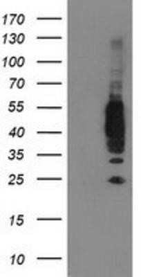 Western Blot: VASP Antibody (OTI4D6) - Azide and BSA Free [NBP2-74830] - HEK293T cells were transfected with the pCMV6-ENTRY control (Left lane) or pCMV6-ENTRY VASP (Right lane) cDNA for 48 hrs and lysed. Equivalent amounts of cell lysates (5 ug per lane) were separated by SDS-PAGE and immunoblotted with anti-VASP.