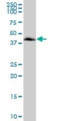 Western Blot: VASP Antibody [H00007408-B01P] - Analysis of VASP expression in human spleen.