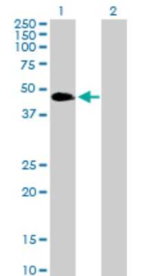Western Blot: VASP Antibody [H00007408-D01P] - Analysis of VASP expression in transfected 293T cell line by VASP polyclonal antibody.Lane 1: VASP transfected lysate(39.80 KDa).Lane 2: Non-transfected lysate.