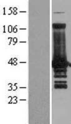 Western Blot: VASP Overexpression Lysate (Adult Normal) [NBL1-17699] Left-Empty vector transfected control cell lysate (HEK293 cell lysate); Right -Over-expression Lysate for VASP.