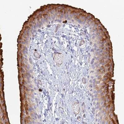 Immunohistochemistry-Paraffin: VAT1 Antibody [NBP1-92569] - Staining of human urinary bladder shows strong cytoplasmic positivity in urothelial cells.