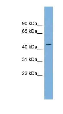 Western Blot: VAT1 Antibody [NBP1-57008] - Jurkat cell lysate, concentration 0.2-1 ug/ml.