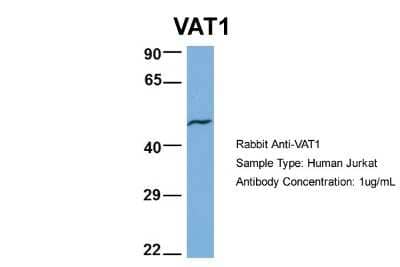 Western Blot: VAT1 Antibody [NBP1-57008] - Jurkat, Antibody Dilution: 1.0 ug/ml VAT1 is supported by BioGPS gene expression data to be expressed in Jurkat.