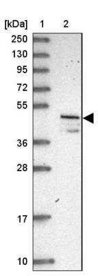 Western Blot: VAT1 Antibody [NBP1-92569] - Lane 1: Marker  [kDa] 250, 130, 95, 72, 55, 36, 28, 17, 10.  Lane 2: Human cell line RT-4