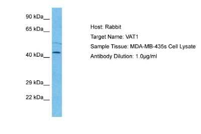 Western Blot: VAT1 Antibody [NBP2-88567] - Host: Rabbit. Target Name: VAT1. Sample Type: MDA-MB-435s Whole Cell lysates. Antibody Dilution: 1.0ug/ml