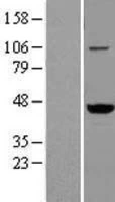 Western Blot: VAT1 Overexpression Lysate (Adult Normal) [NBL1-17700] Left-Empty vector transfected control cell lysate (HEK293 cell lysate); Right -Over-expression Lysate for VAT1.