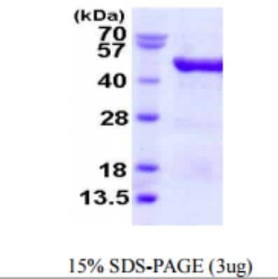 SDS-Page: VAT1 Recombinant Protein [NBP1-78838]